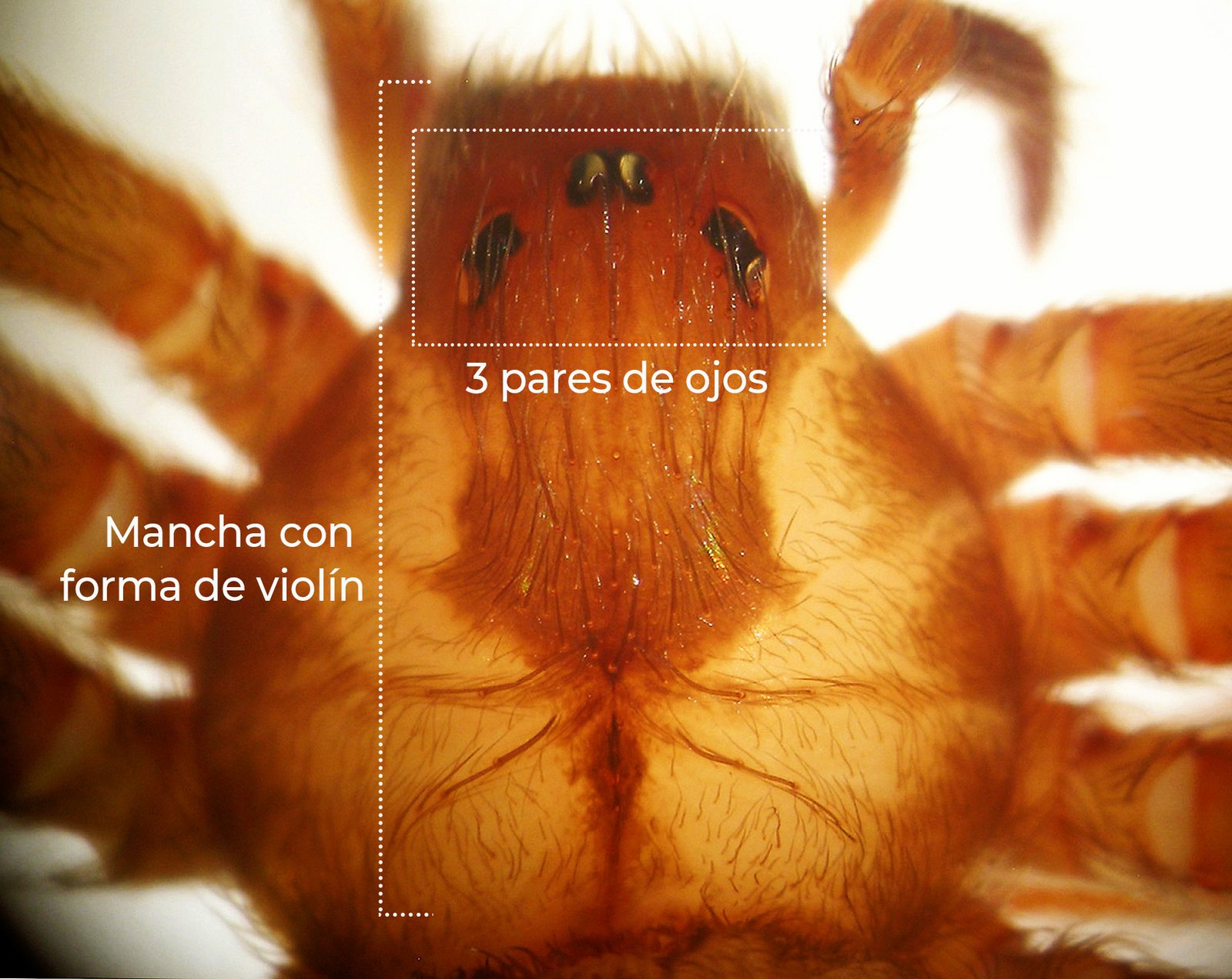 Mancha en forma de violín y disposición de los ojos